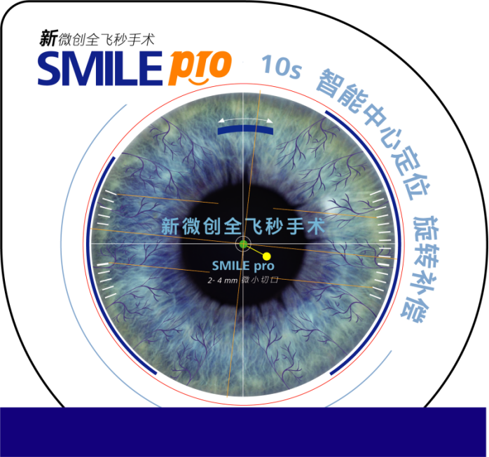 新一代全飛秒Smile pro 超快智能更安全(1)490